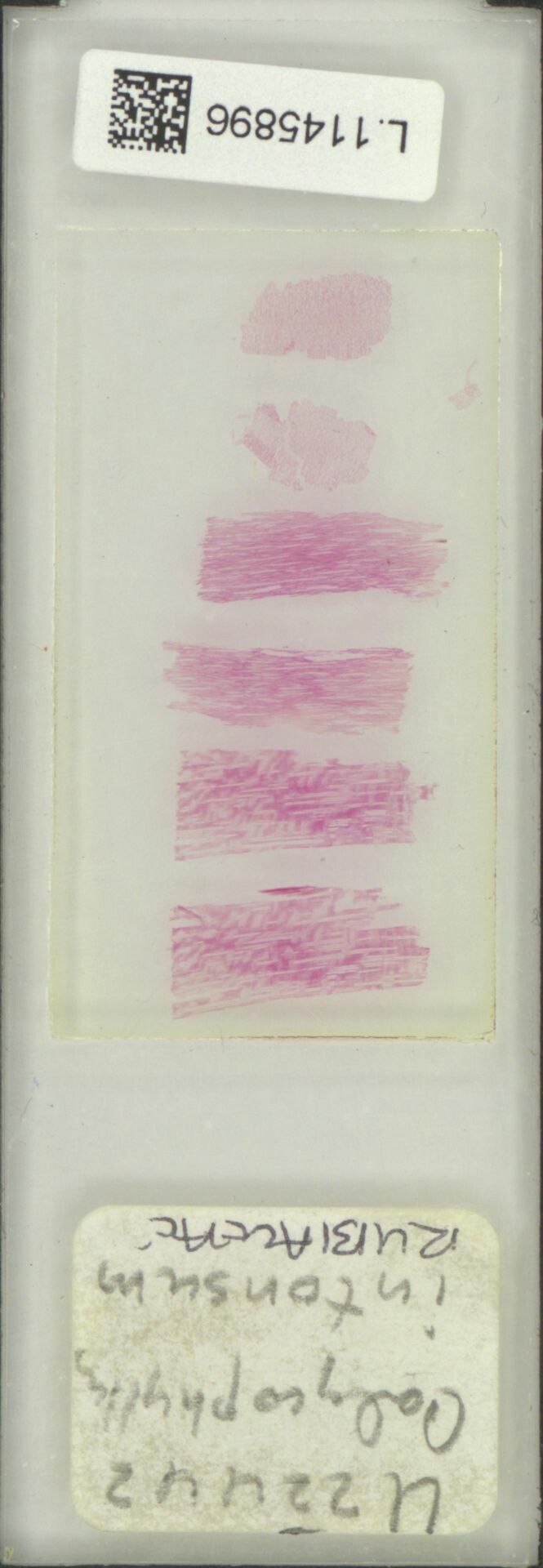 Calycophyllum intonsum